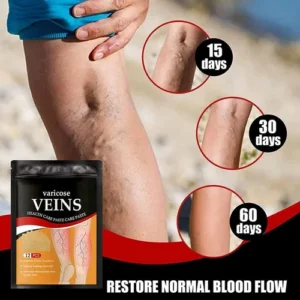 Pack Parches Para Varices X4 - Image 3