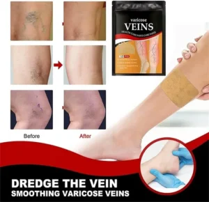 Pack Parches Para Varices X4 - Image 4