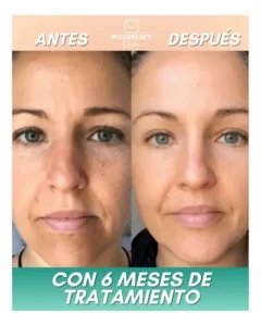 Mascarilla Colageno SOLUBLE 5u Rostro - Image 2