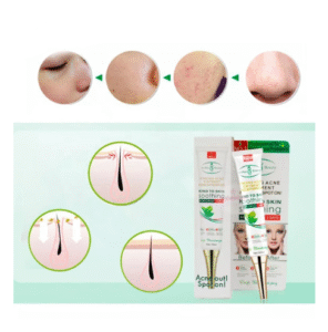 GEL ELIMINA ACNE - Image 3