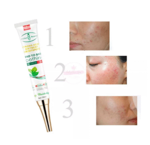 GEL ELIMINA ACNE - Image 2